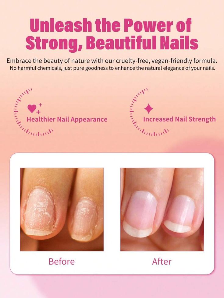 Nail Growth Serum